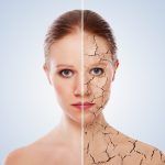 dehydrated skin cracks