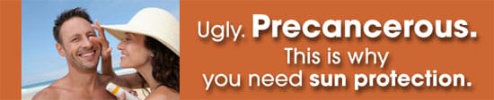 Ugly. Precancerous. This is why you need sun protection.