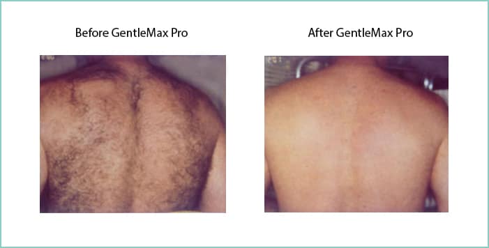 before and after 2