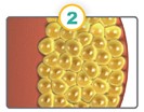CoolSculpting fat cells diagram.
