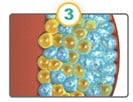 CoolSculpting crystallized fat cells diagram.