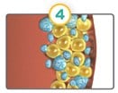 CoolSculpting dying fat cells diagram.