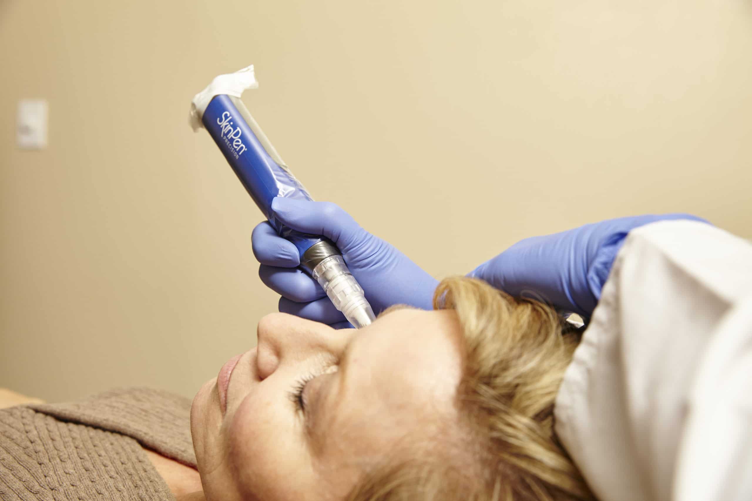SkinPen Microneedling at SkinCare Austin